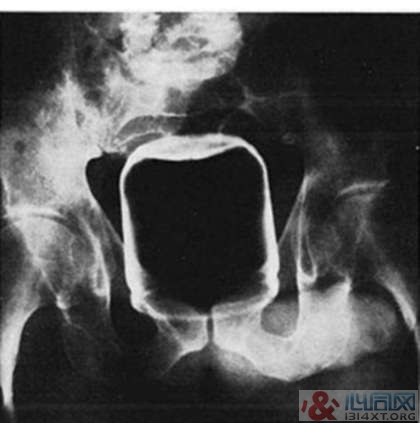 XƬչʾڵ10󲻿˼顱