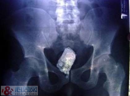 XƬչʾڵ10󲻿˼顱