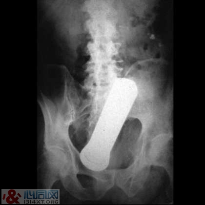 XƬչʾڵ10󲻿˼顱