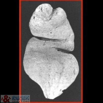 X光片展示“肛门内的10大不可思议”