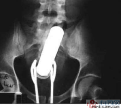 XƬչʾڵ10󲻿˼顱