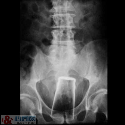 XƬչʾڵ10󲻿˼顱