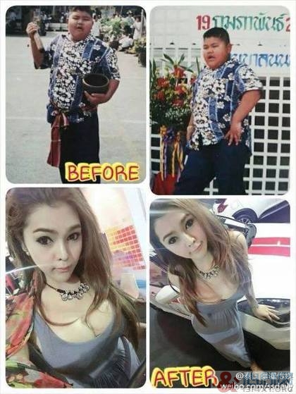 泰国变性手术神改造!胖弟变性变辣妹